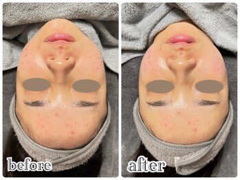 ニュイ(nuit)/ララピール4回目