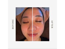 マオ(mao)/☆1回Before→after☆