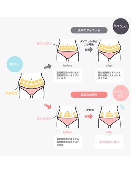 シュシュ(chouchou)/脂肪冷却 仕組み