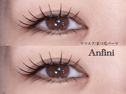 アンフィニ(Anfini)の写真