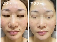 ナオフクオカ ヒーリングフォースエヌ(NaoFukuoka/healingforceN)/肌活力を上げ美しくなりましょう