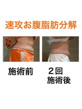 鍼灸サロンオランジュ 高槻富田院/