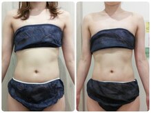 鈴木整体院 仙台泉院/小顔造顔/骨盤矯正/痩身整体