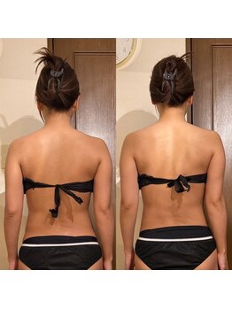 月ノユメ(tsukinoyume)/全身整体+WINBACKで美骨格造形