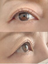 ムニ(muni)/LEDフラットラッシュ80本