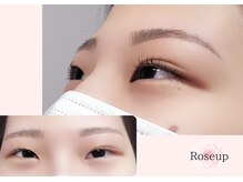 ローズアップ(Roseup)/