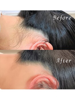 ララリア(LaLaLia)/うなじWAX脱毛