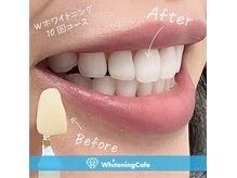 ホワイトニングカフェ 鹿児島中央駅前店(WhiteningCafe)の雰囲気（ホワイトニングの症例写真はフォトギャラリーをCheck！）