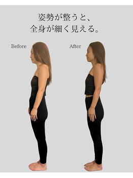 リ バース 立川(RE:birth)/姿勢改善　BeforeAfter