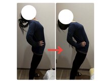 エクラ(e'clat)/急性的な肩凝り・腰痛の方