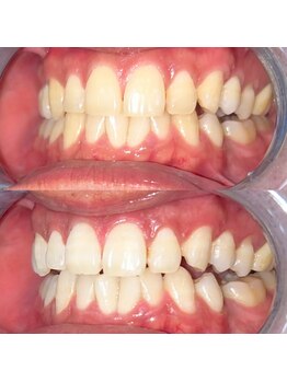 ライトビューティー 池袋店(LightBeauty)/症例写真