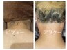 【学割U24】　全身脱毛のみ　特別クーポン　￥11.000→￥5.000