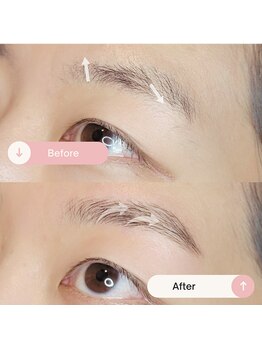 シャルトルズ/症例写真６