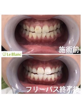 ルブラン 奈良店(Le Blanc)/老若男女問わず人気です!