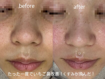 フィー(Fee)の写真