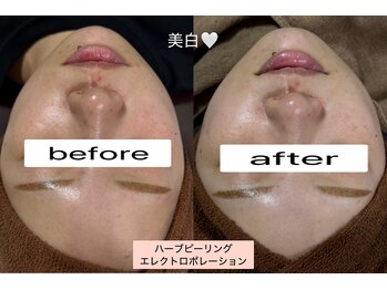 シロ(SHIRO)/美白と保湿のダブル効果