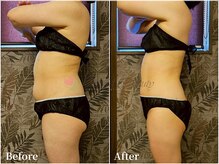 ワールドビューティー(World Beauty)/滝汗デトックス×強圧リンパ痩身