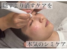 シミケア放題！肌のターンオーバーを利用して肌負担が少ない