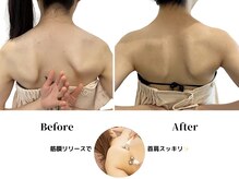 ベル(BeL)/筋膜リリース40分