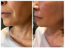 ペリドット(Peridot)/【最先端美容レッドショット】