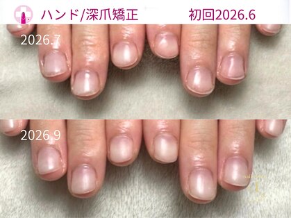 プラスワン(+1)の写真