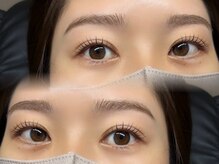 ノイ(noi)の雰囲気（お目元に合わせたデザインでパッチリ可愛く！）
