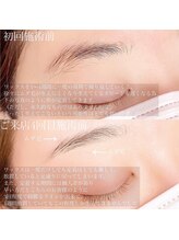 アイウェーブ(Eye wave)/マップブローワックス