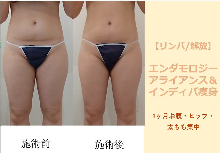 外苑前駅でエンダモロジーが人気のエステサロン｜ホットペッパー