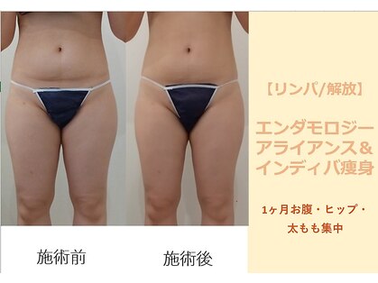 クレール アオヤマ(CLAIRE AOYAMA)の写真