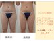 クレール アオヤマ(CLAIRE AOYAMA)の写真