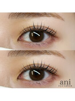 アニ 恵比寿(ani)/バリジェンヌ