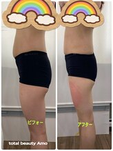 アモ(amo)/【脂肪冷却4回目】