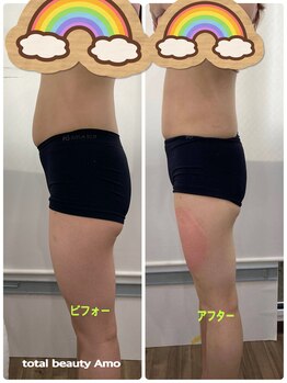 アモ(amo)/【脂肪冷却4回目】