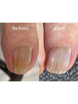 爪の悩みを解消できる（ケア含む）