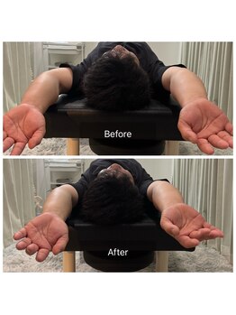 ナオル整体 広島福山院(NAORU整体)/万歳/猫背/肩こり→Before/After