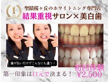 ホワイトニングショップ 多摩店
