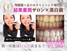 ホワイトニングショップ 多摩店