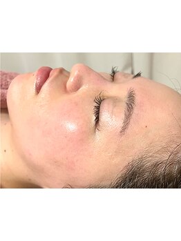 お肌をきれいにしたい