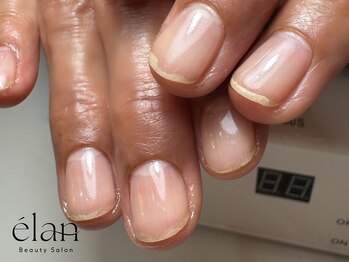 エラン(elan)の写真/どこに行っても持ちが悪い！様々なトラブルを抱えた方！健康的で美しい指先を叶える土台作りをお手伝い★