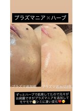 ビエン(bien)/ハーブ×プラズマニア