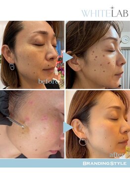 マハロ(mahalo)/ホワイトラボ