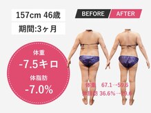 テテアテテ(tete a tete)の雰囲気（県内希少の脂肪冷却でがっつり痩せ!痩せにくくなってきた方にも!）