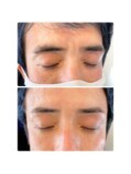 アイビー 神保町店(i.b)/眉【before⇒after】８９