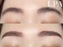 レピア 仙台店/韓国式LEPIA Before&Aｆter