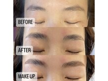 エム(emu)/眉（ハリウッドブロウリフト）