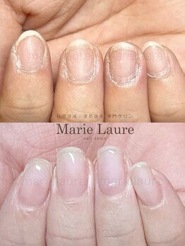 マリーロール 天王寺店(Marie Laure)/深爪改善/自爪育成/ネイルケア