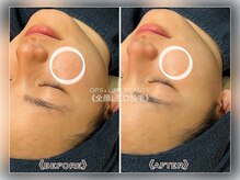 オプス ライフビューティー(OPS×LIFE BEAUTY)/学生さんも通いやすい