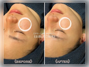 オプス ライフビューティー(OPS×LIFE BEAUTY)/学生さんも通いやすい