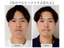 エピファニー(Epiphany)/30代　顔の大きさが悩みでした