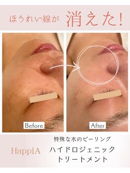 ハピア(HappiA)/ハイドロジェニック　1回